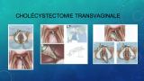 Diapositive49